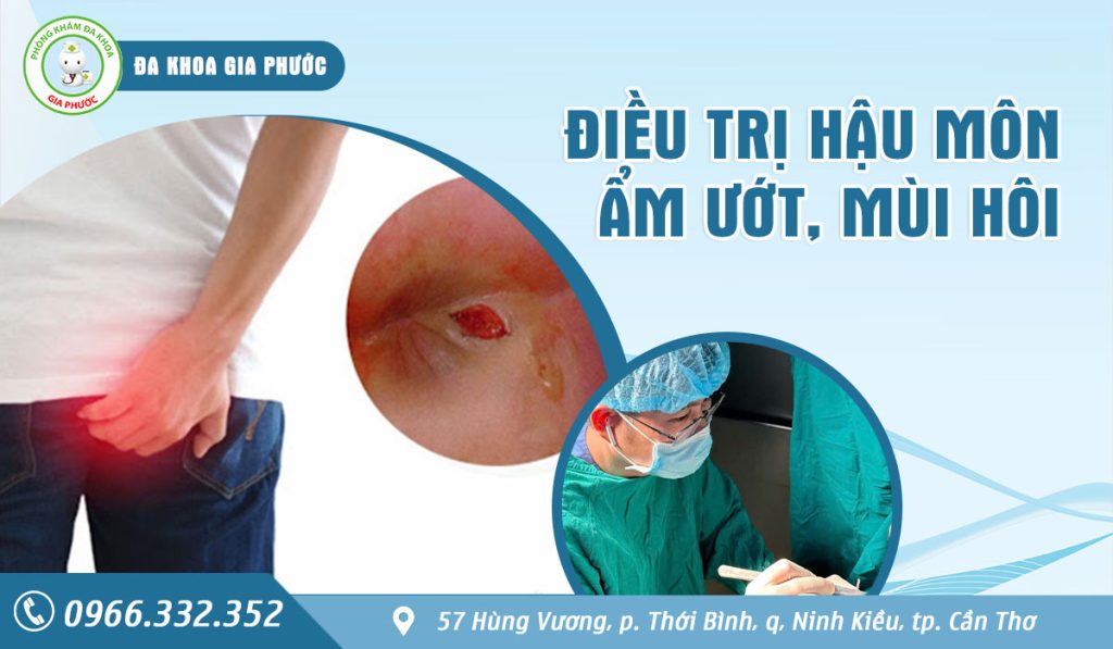 Hậu môn ẩm ướt có mùi hôi nên thăm khám và điều trị sớm để tránh hệ lụy nguy hiểm đối với sức khỏe