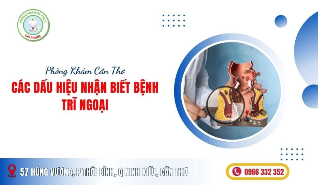 Các dấu hiệu nhận biết bệnh trĩ ngoại