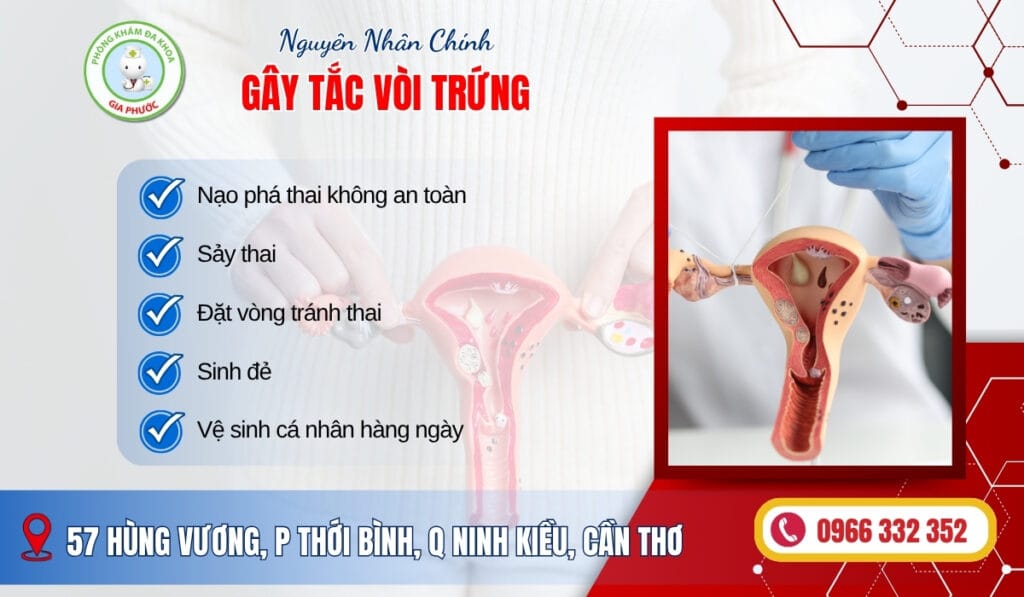 Nguyên nhân gây tắc vòi trứng 2