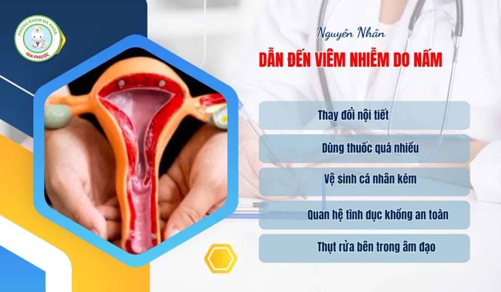 Nguyên nhân và biểu hiện viêm âm đạo do nấm