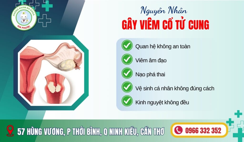 Các nguyên nhân gây viêm cổ tử cung