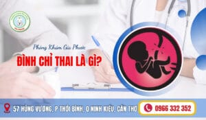 Đình chỉ thai là gì