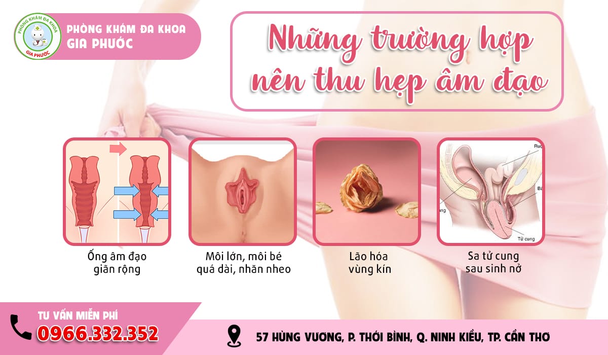 Những trường hợp nên thẩm mỹ vùng kín