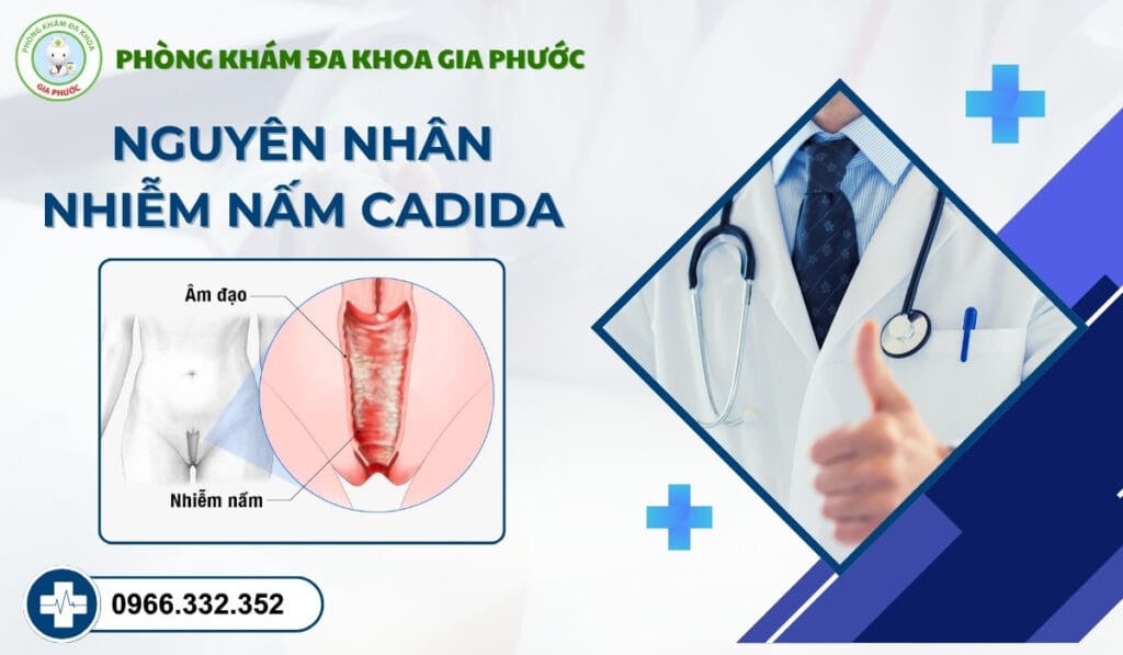 Nhiễm nấm cadida ở bao quy đầu