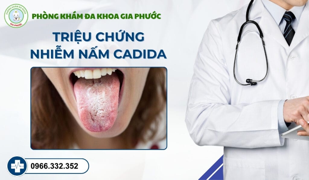 Nhiễm nấm cadida ở bao quy đầu