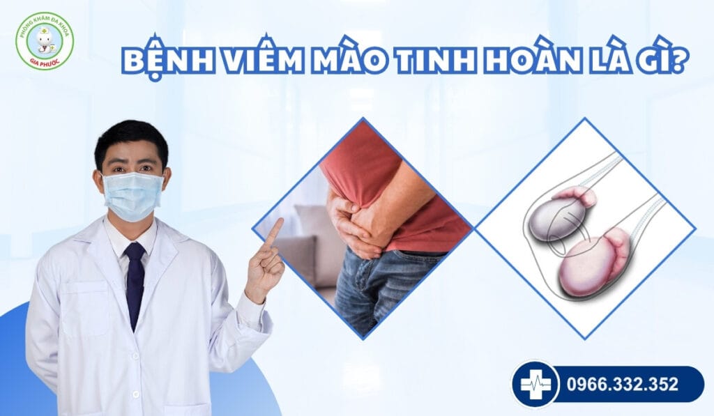Chi phí điều trị viêm mào tinh hoàn

