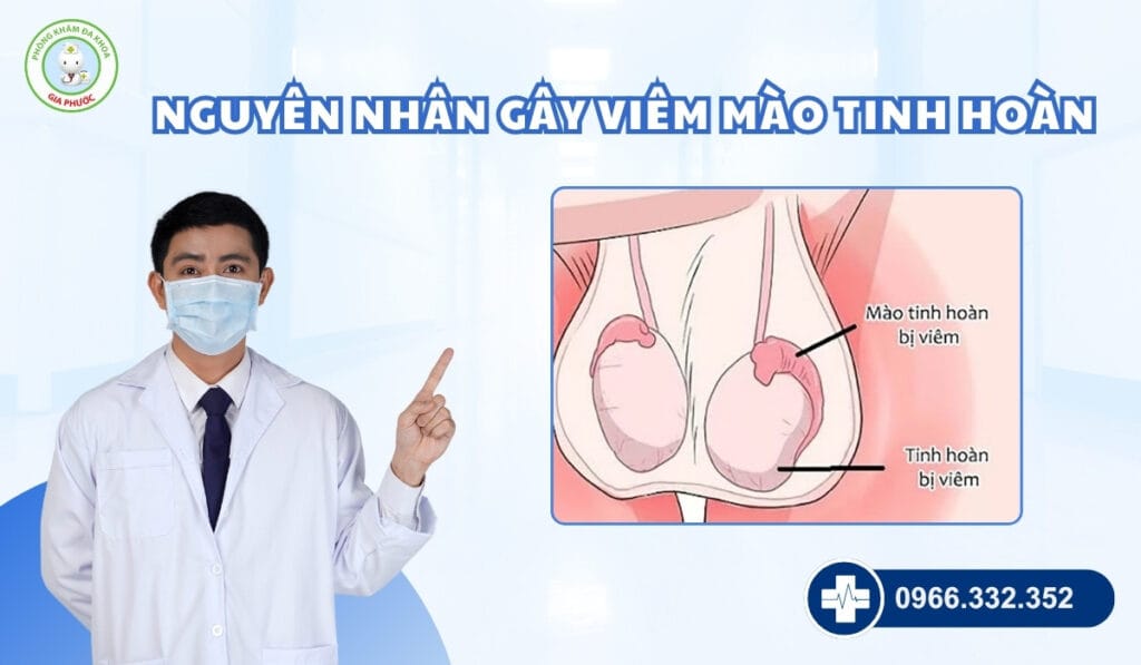 Chi phí điều trị viêm mào tinh hoàn