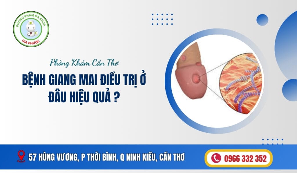 Benh-Giang-Mai-Dieu-Tri-O-Dau-Hieu-Qua-Phong-Kham-Da-Khoa-Gia-Phuoc-–-Dia-Chi-Tin-Cay-1024x597
