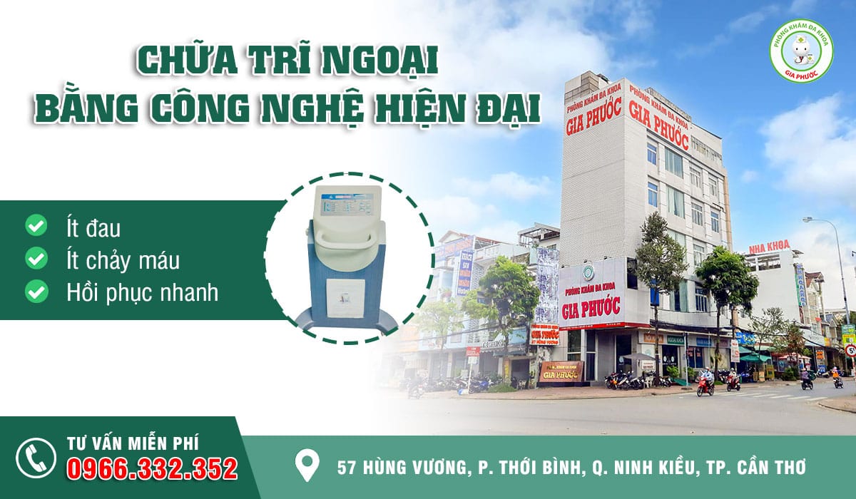 Cơ sở điều trị bệnh trĩ ngoại ở Cần Thơ