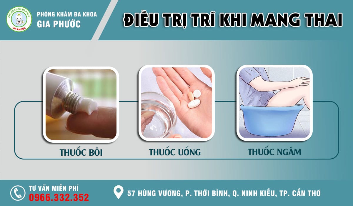 Phương pháp điều trị bệnh trĩ khi mang thai cho các mẹ bầu nhưng vẫn an toàn cho thai nhi