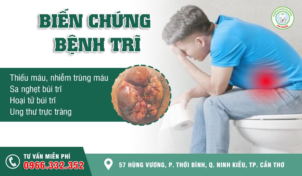 Biến chứng bệnh trĩ nếu không điều trị