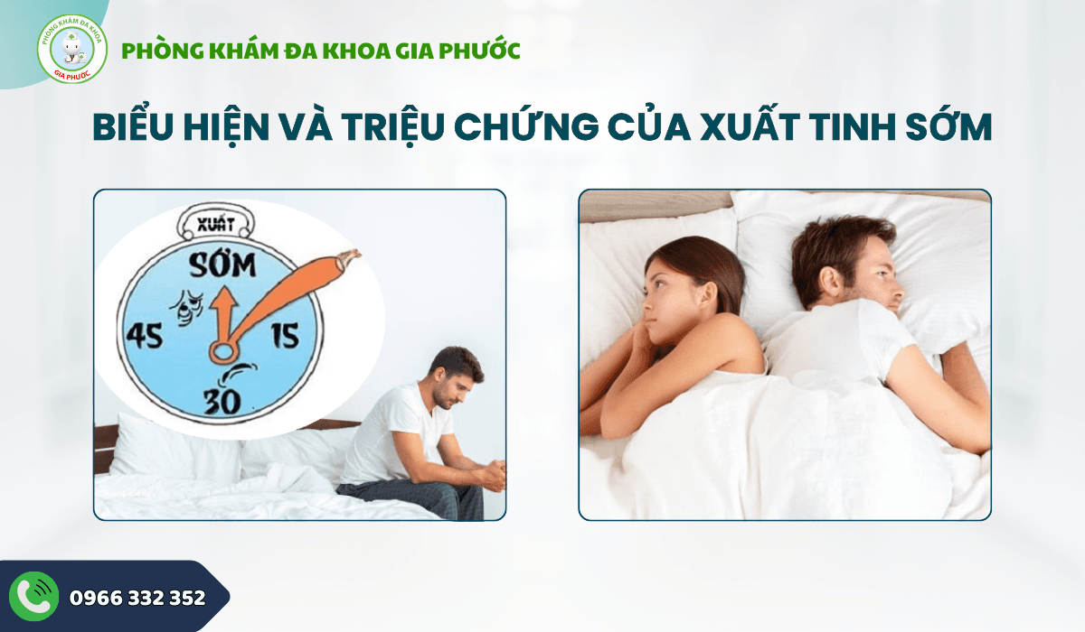 Biểu hiện và triệu chứng xuất tinh sớm