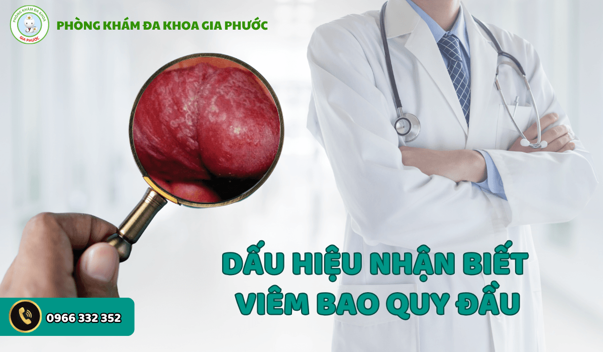 Cách điều trị viêm bao quy đầu hiệu quả