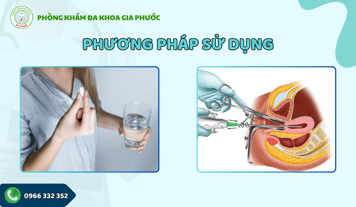 Phá thai từ 6 tuần đến 12 tuần