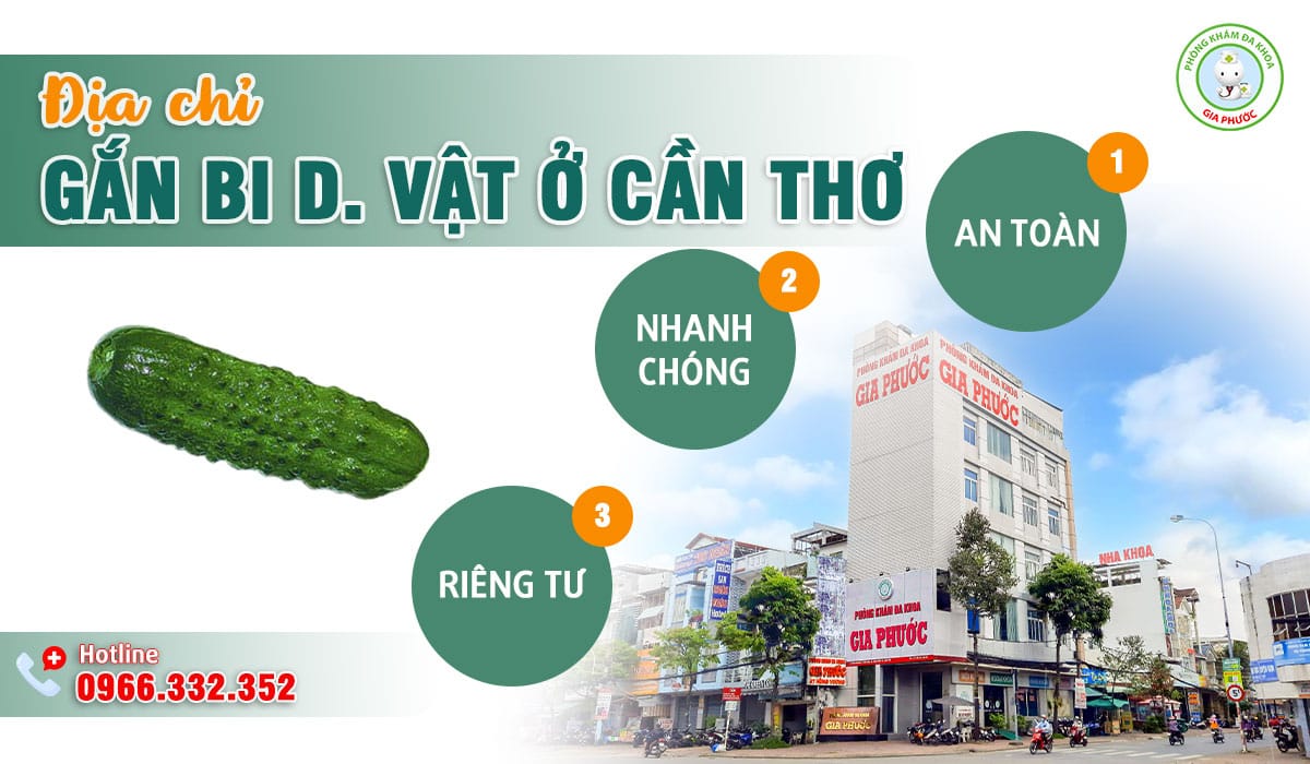Địa chỉ gắn bi dương vật tại Cần Thơ