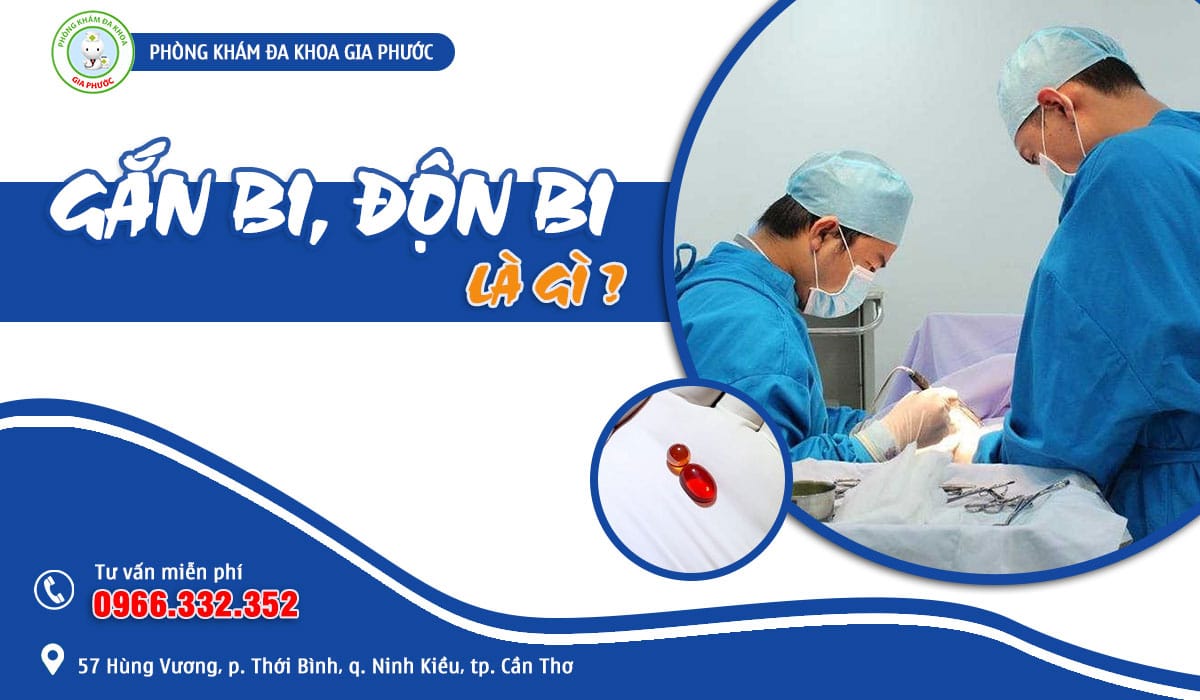Tìm hiểu về thủ thuật gắn bi, độn bi tăng kích thước dương vật