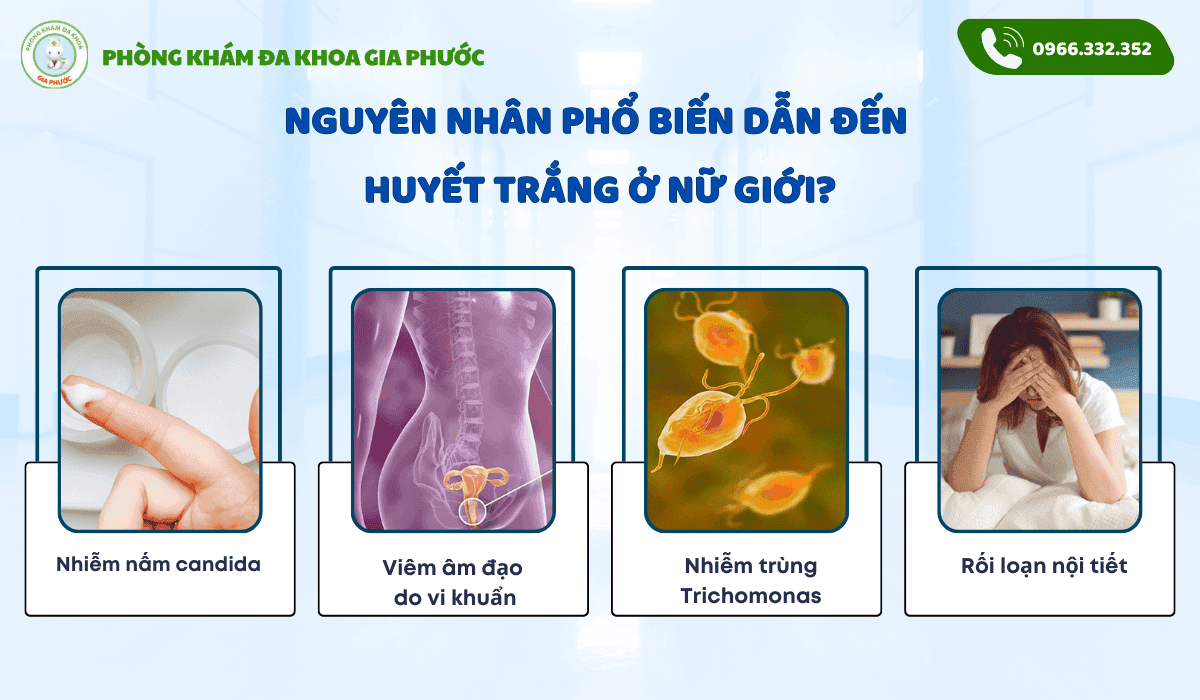 Cách điều trị huyết trắng tại nhà
