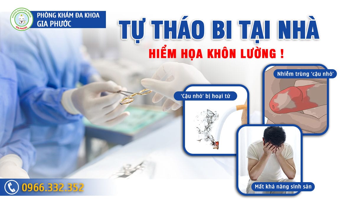 Hiểm họa khi tự tháo bi tại nhà