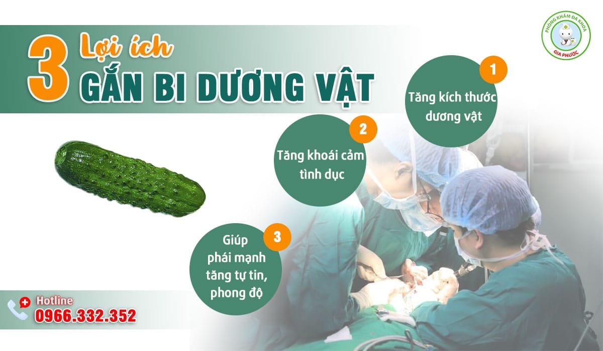 Những lợi ích khi gắn bi dương vật tại Cần Thơ