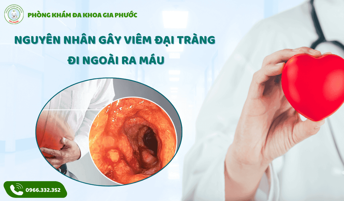 Viêm đại tràng đi ngoài ra máu