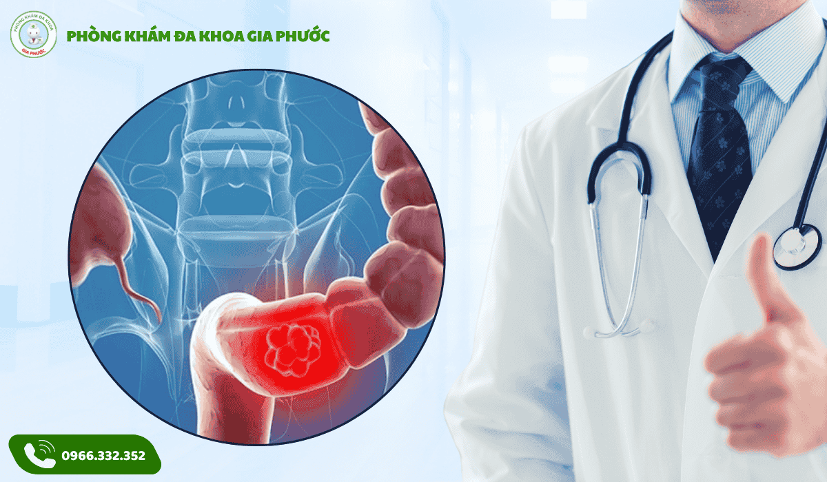 Viêm đại tràng đi ngoài ra máu