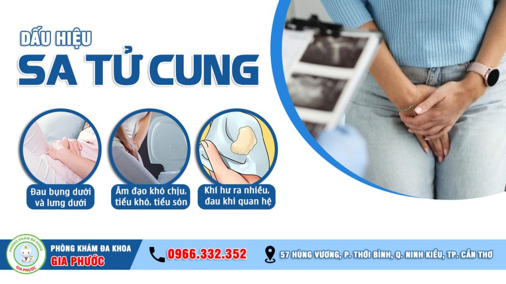 Dấu hiệu sa tử cung sau sinh dễ nhận biết nhất