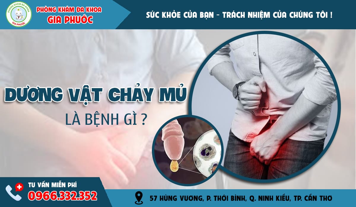 Dương vật chảy mủ là bệnh gì?