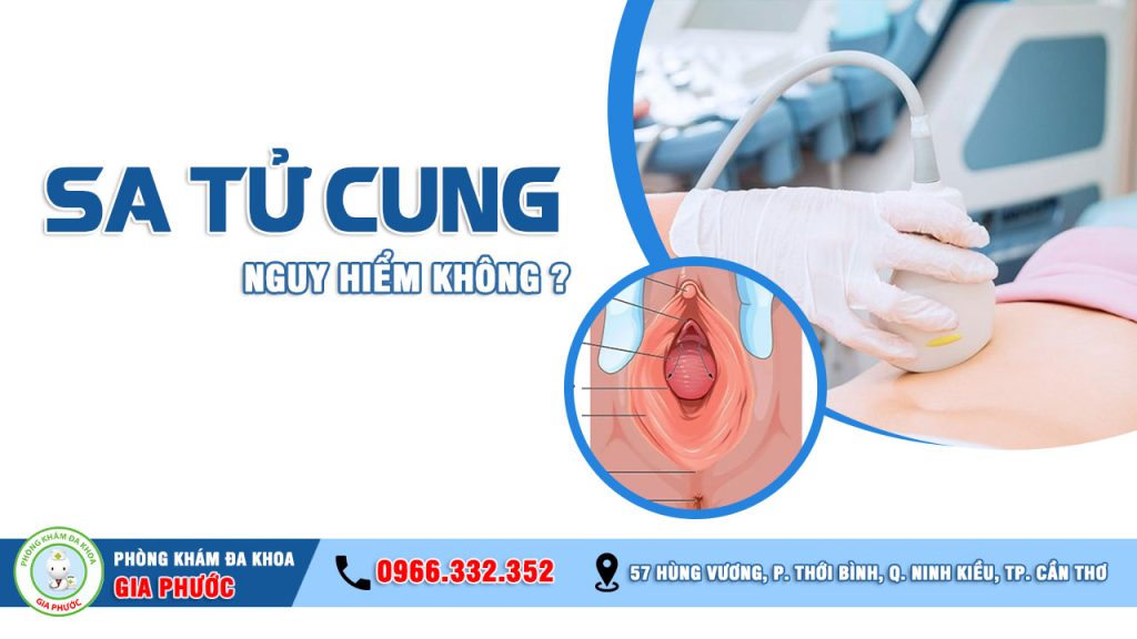 Bệnh sa tử cung có nguy hiểm không?