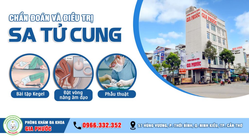 Chẩn đoán và điều trị sa tử cung sau sinh tại phòng khám đa khoa Gia Phước