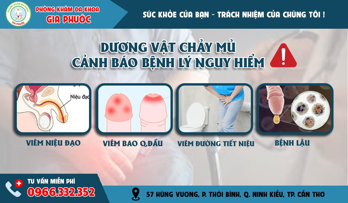 Nguyên nhân gây dương vật chảy mủ ở nam giới