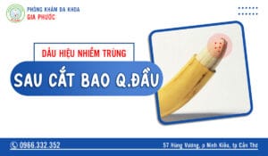 Dấu hiệu nhiễm trùng sau cắt bao quy đầu
