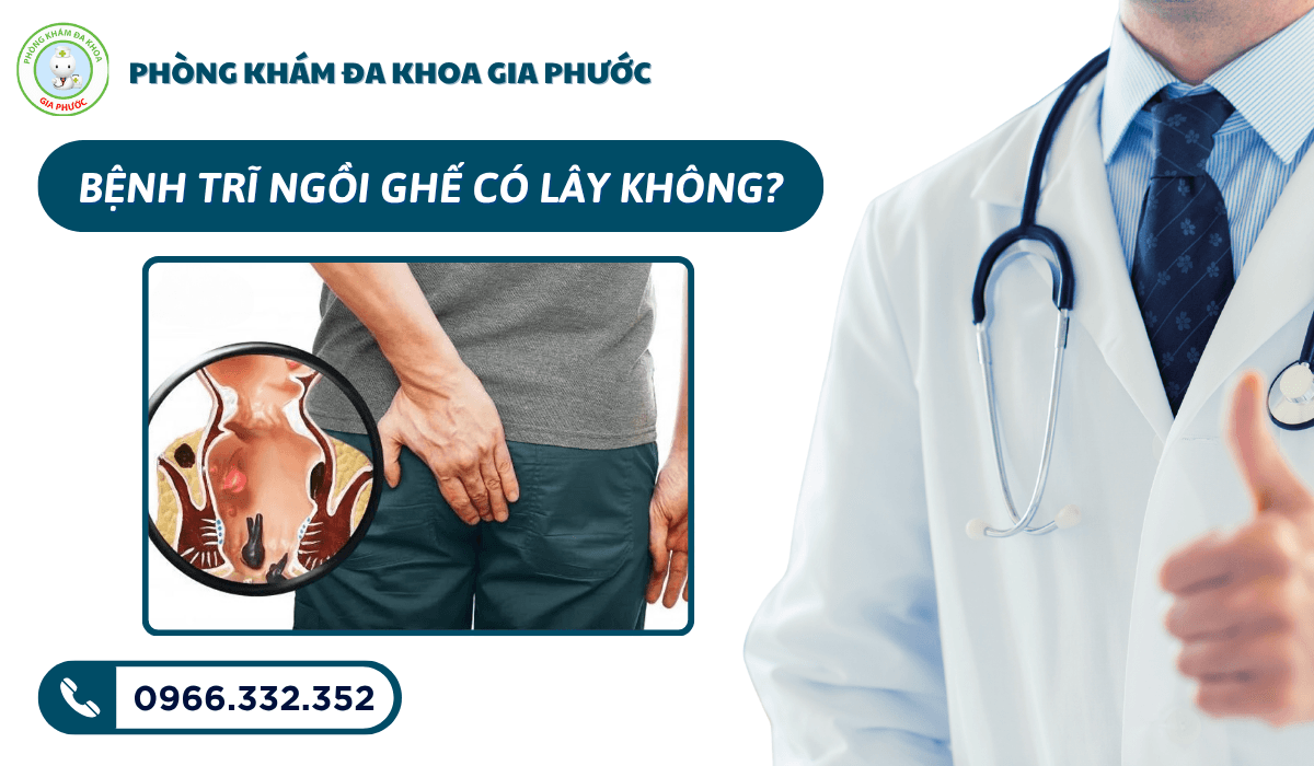 Bệnh trĩ ngồi ghế có lây không