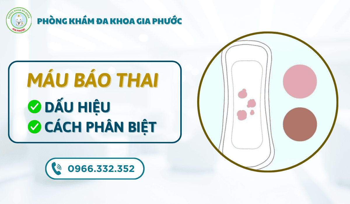 Máu báo thai