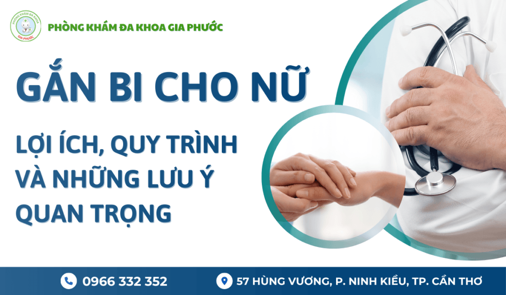 Gắn bi cho nam