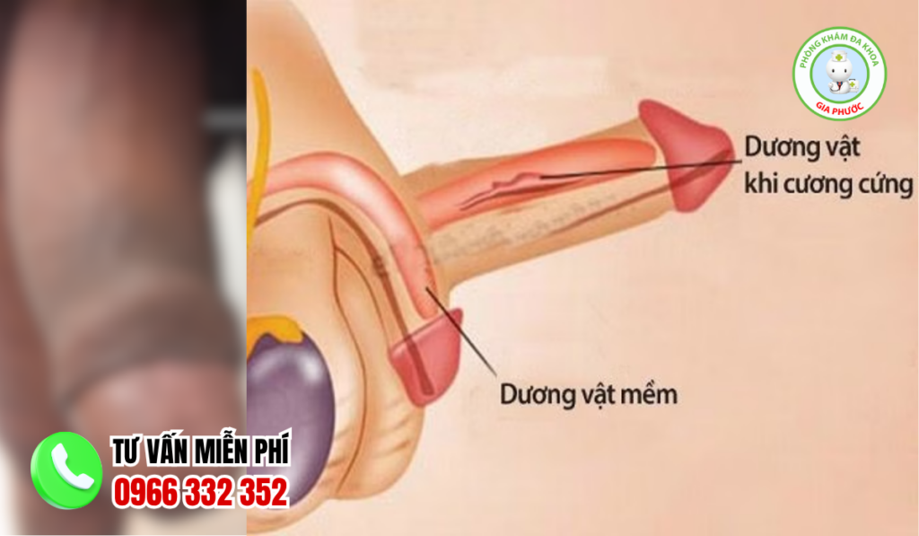 Cấu tạo hình ảnh dương vật từ bên ngoài