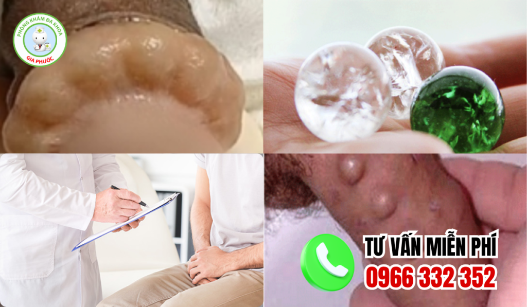 Hình ảnh gắn bi cho nam giới