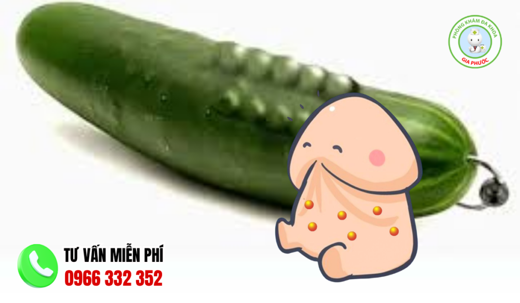 Hình ảnh gắn bi cho nam giới chuẩn y khoa