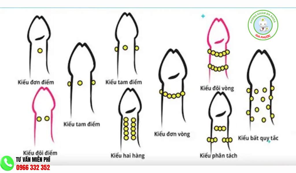 hình ảnh gắn bi cho nam