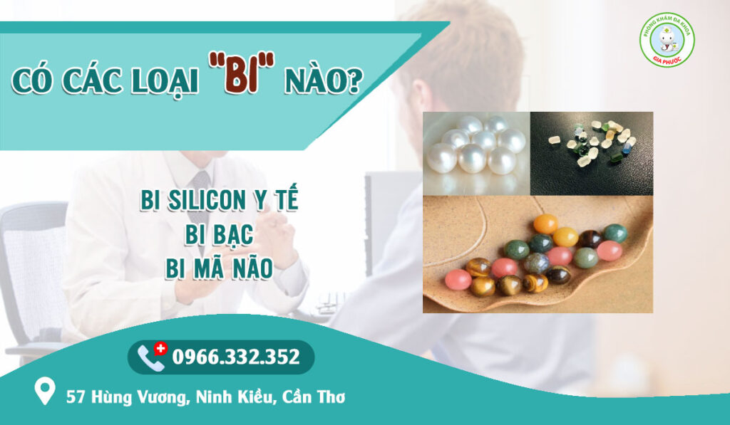 Có các loại bi nào thường dùng để gắn bi/độ bi