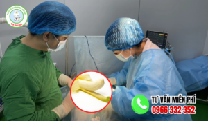 Địa chỉ cắt bao quy đầu an giang