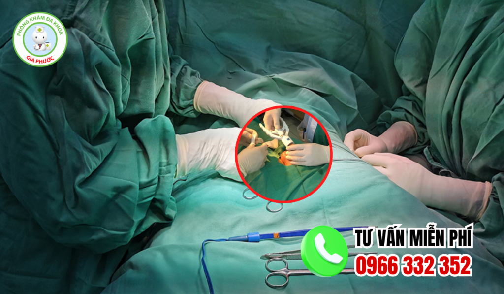 Địa chỉ cắt bao quy đầu bạc liêu