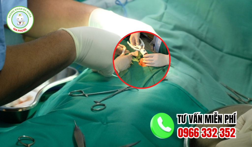 Địa chỉ cắt bao quy đầu cà mau