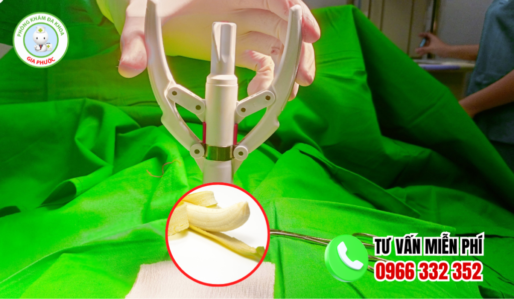 Địa chỉ cắt bao quy đầu đồng tháp