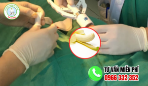 Địa chỉ cắt bao quy đầu hậu giang