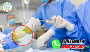 Địa chỉ cắt bao quy đầu sóc trăng