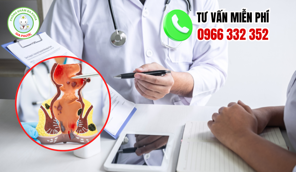 Địa chỉ khám chữa trĩ hậu giang