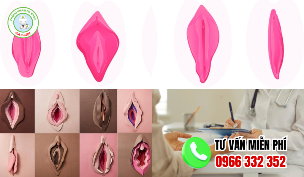 Hình ảnh môi bé phì đại
