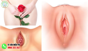 Hình ảnh môi cô bé bình thường