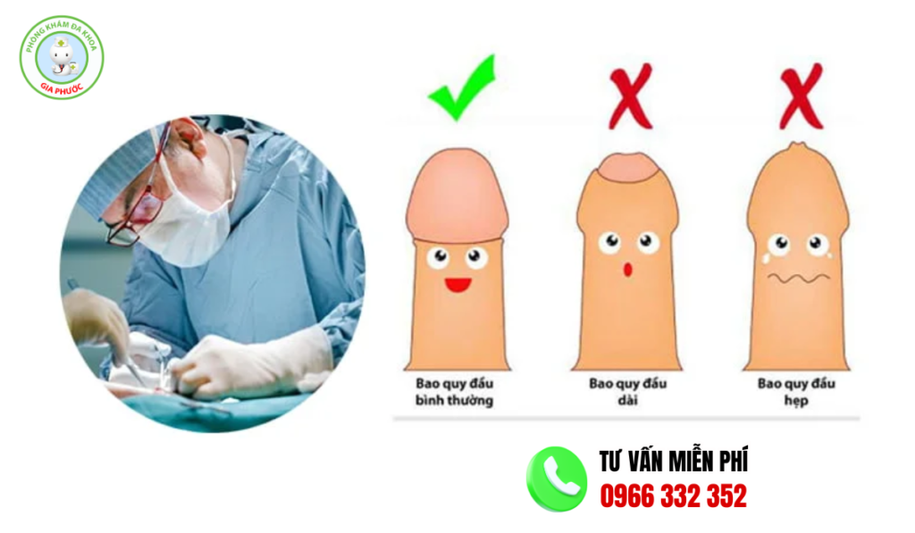 Hình ảnh trước và sau khi cắt bao quy đầu