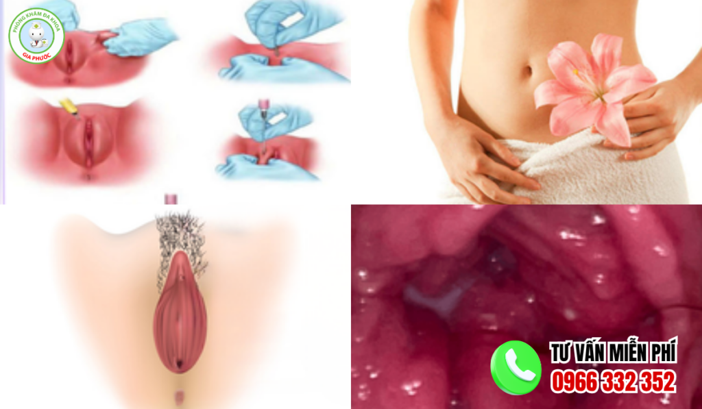 Hình ảnh môi cô bé bình thường